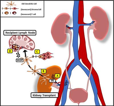 Donor and Recipient Age-Mismatches: The Potential of Transferring Senescence